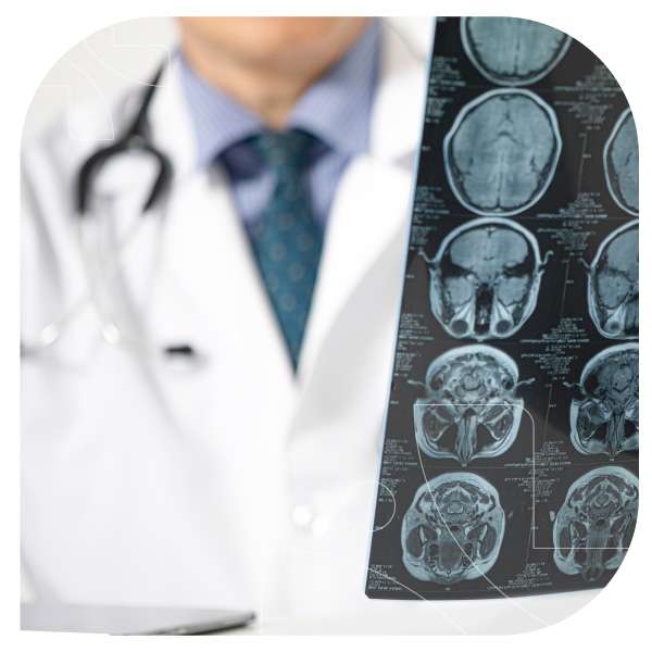 img-neuro-vivosaludcl